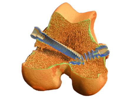 Micro-CT Imaging in the Life Sciences Image
